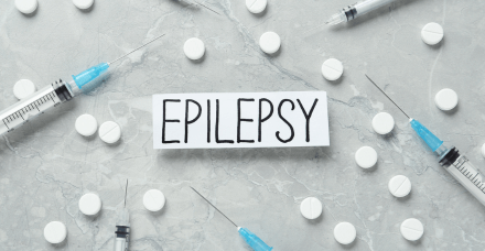 Epilepsy